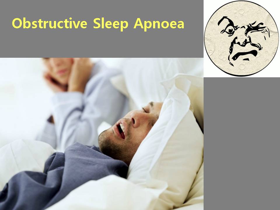 Obstructive Sleep Apnoea (Snoring)