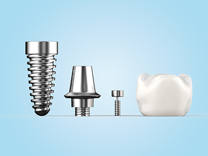 Dental implants
