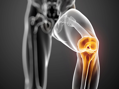 Total hip or knee or elbow replacement